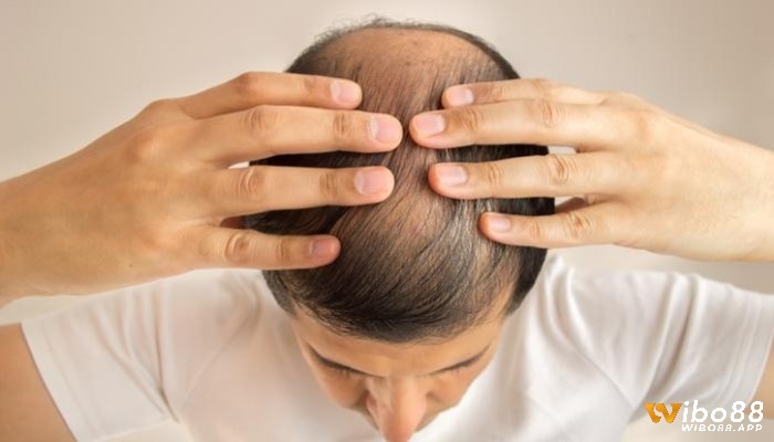 Giấc mơ thấy rụng tóc đem lại cho bạn vận may trong trò chơi lô đề 